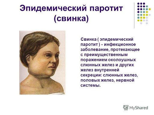 Как Выглядит Свинка Болезнь У Детей Фото — New-Freepik.Ru